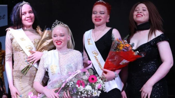 Albino pageant